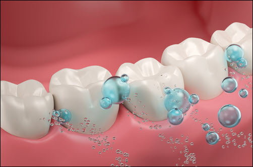 Fluoride
